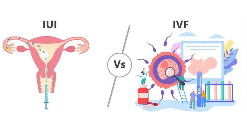 IUI vs. IVF: Understanding the Differences and Making Informed ...